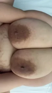 暴躁小护士1封面图