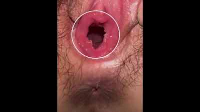 老婆的粉嫩逼洞直接看到子宫口封面图